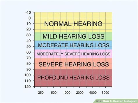 How to Read an Audiogram: 15 Steps (with Pictures).